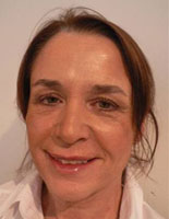 After Evolence Treatment