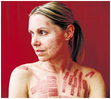 Charlotte Cripps - IPL Burns