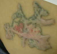 Image: Unusually, the entire tattoo had been treated with lactic acid ...