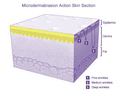 Layers Of The Skin. Once the outer layer of skin