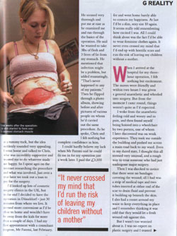 Glamour Magazine - Kelly`s Plastic Surgery Nightmare Page 2