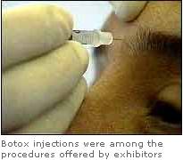 Botox Injection