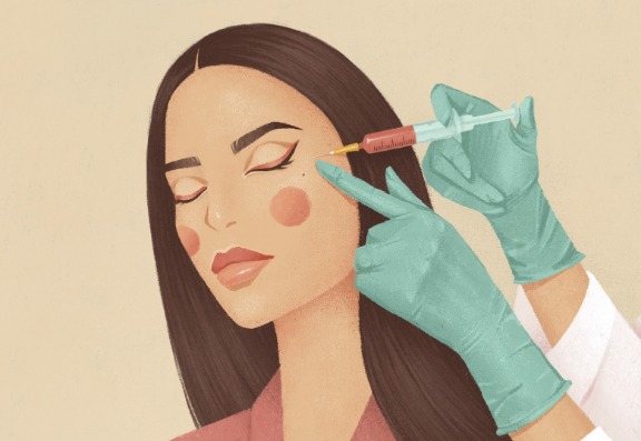 Achieving Natural Results With Fillers