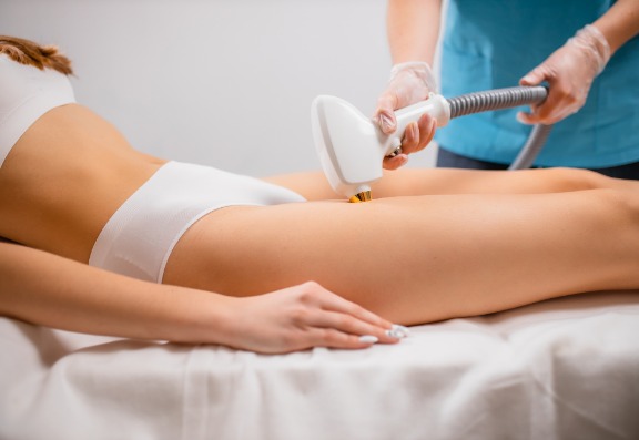 Electrolysis Leaves Scars