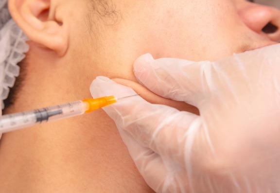 What is Masseter or Jaw Slimming Botox?