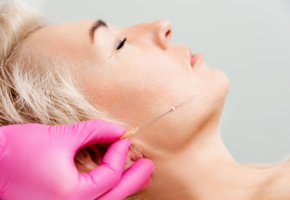 Thread Lift treatment