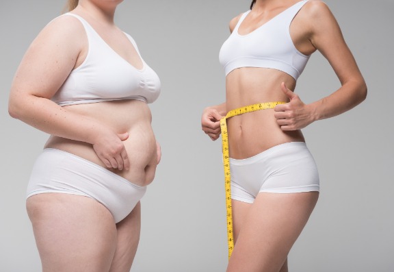 What Factors Can Affect the Success of CoolSculpting?