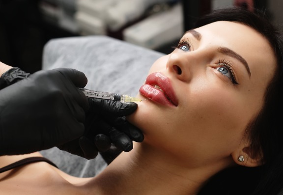 Is Lip Filler Safe?