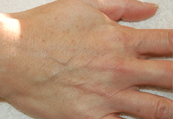 How your hands give your age away