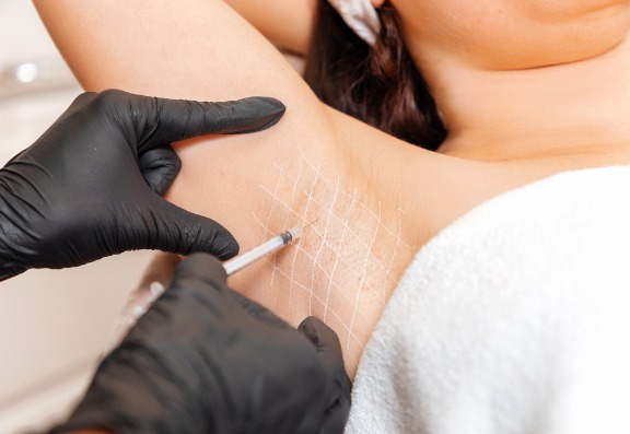 Sweating Hyperhidrosis Treatment