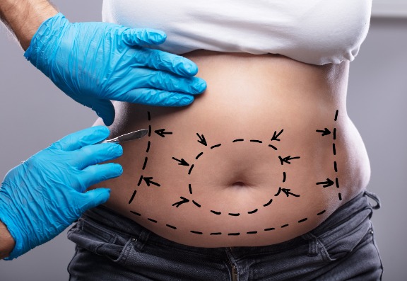 One size doesn’t fit all One size doesn’t fit all