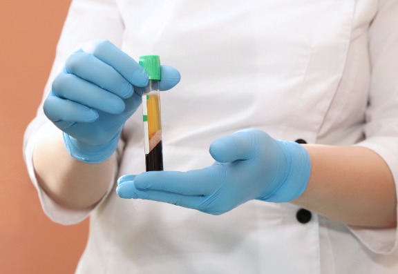 Not All PRP Is Created Equal.