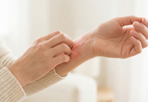 What is Sensitive Skin?