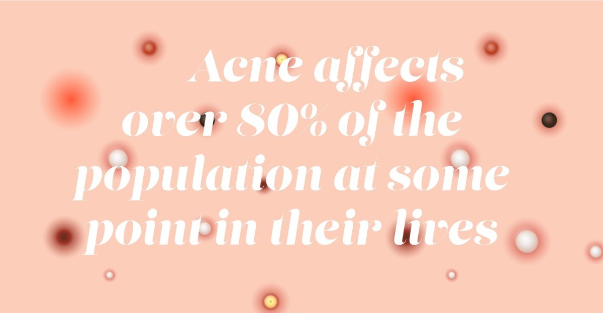 The average UK acne sufferer's annual skincare spend The average UK acne sufferer's annual skincare spend