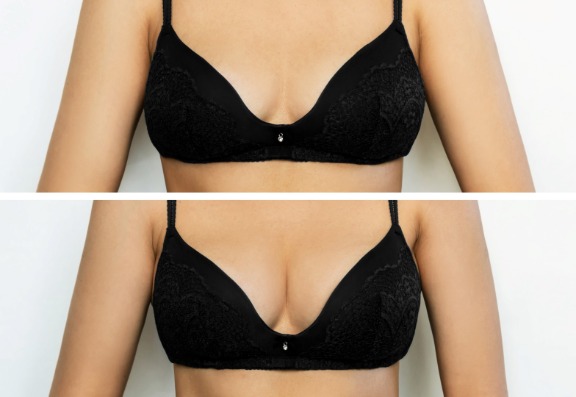 Increase breast size dignitally