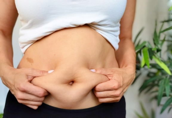 Does Liposuction reduce the risk of heart disease