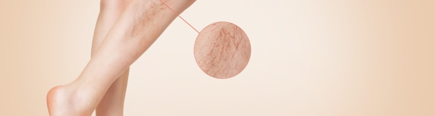 Veins