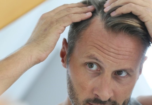 Thinning of hair treatment