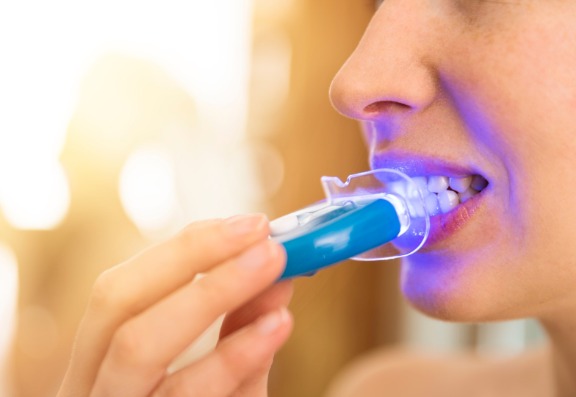 How effective are professional at home teeth whitening