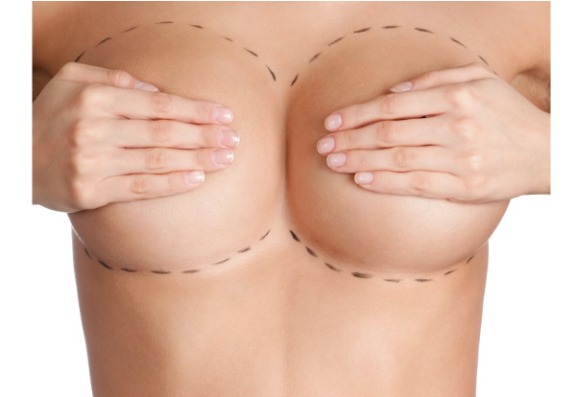 Will breast augmentation affect your ability to breastfeed?