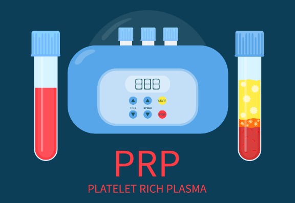 How useful is PRP treatment