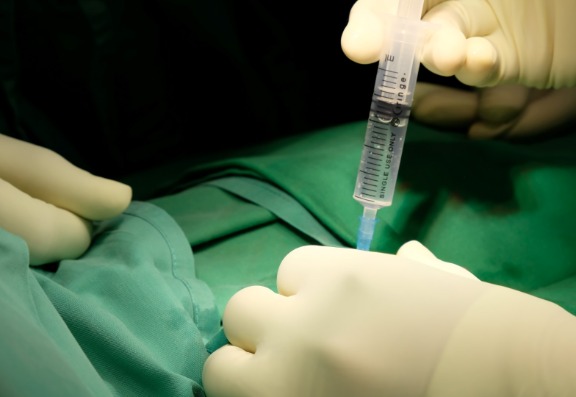 Advantages of a surgical procedure under local anaesthetic