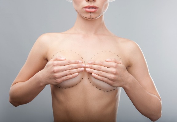 Breast augmentation treatment