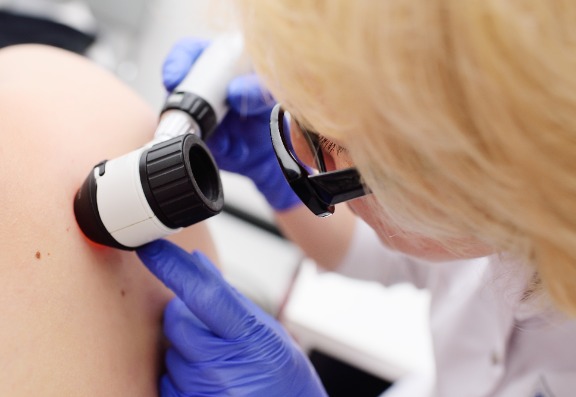 Identifying Skin Cancer