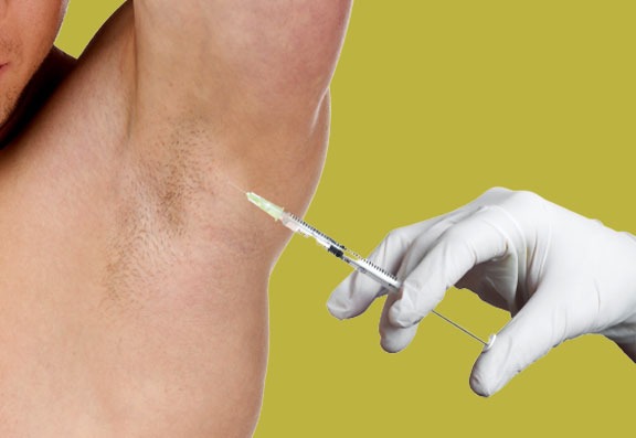 Using Botox as a remedy to cure hyperhidrosis