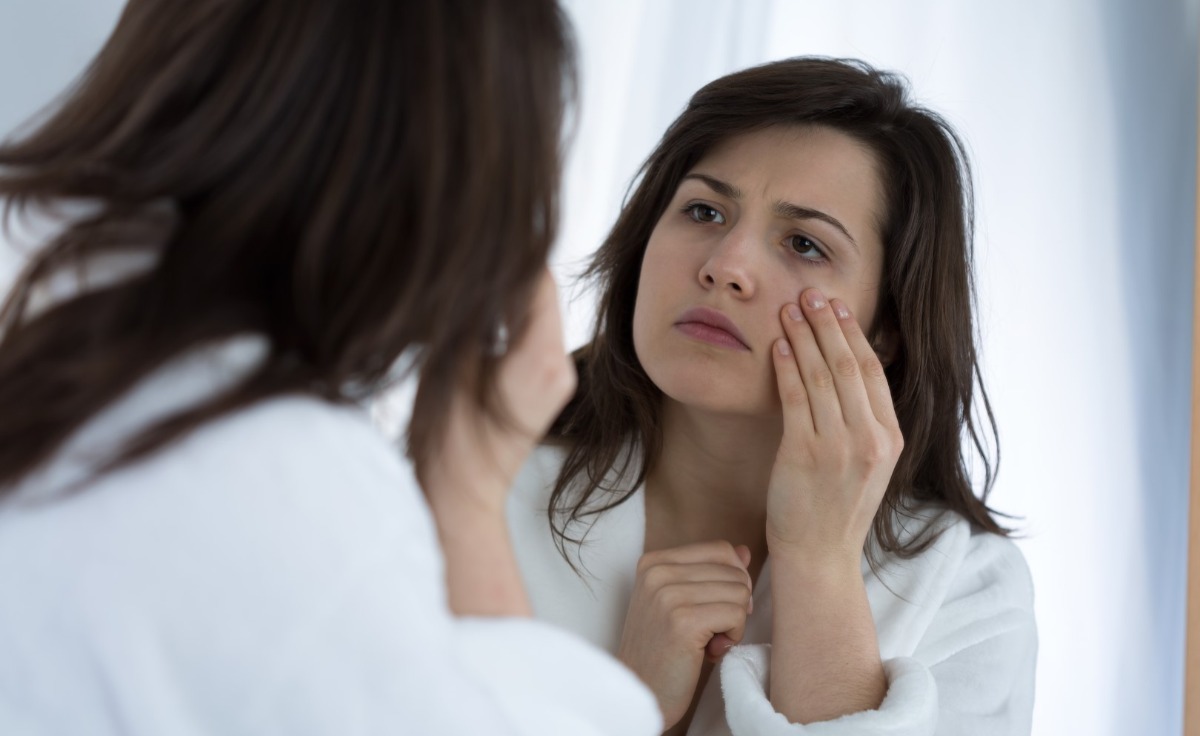 What is a Profhilo treatment