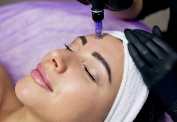 What happens during a micro needling treatment