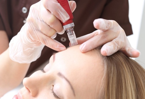 Tips to help with hair restoration