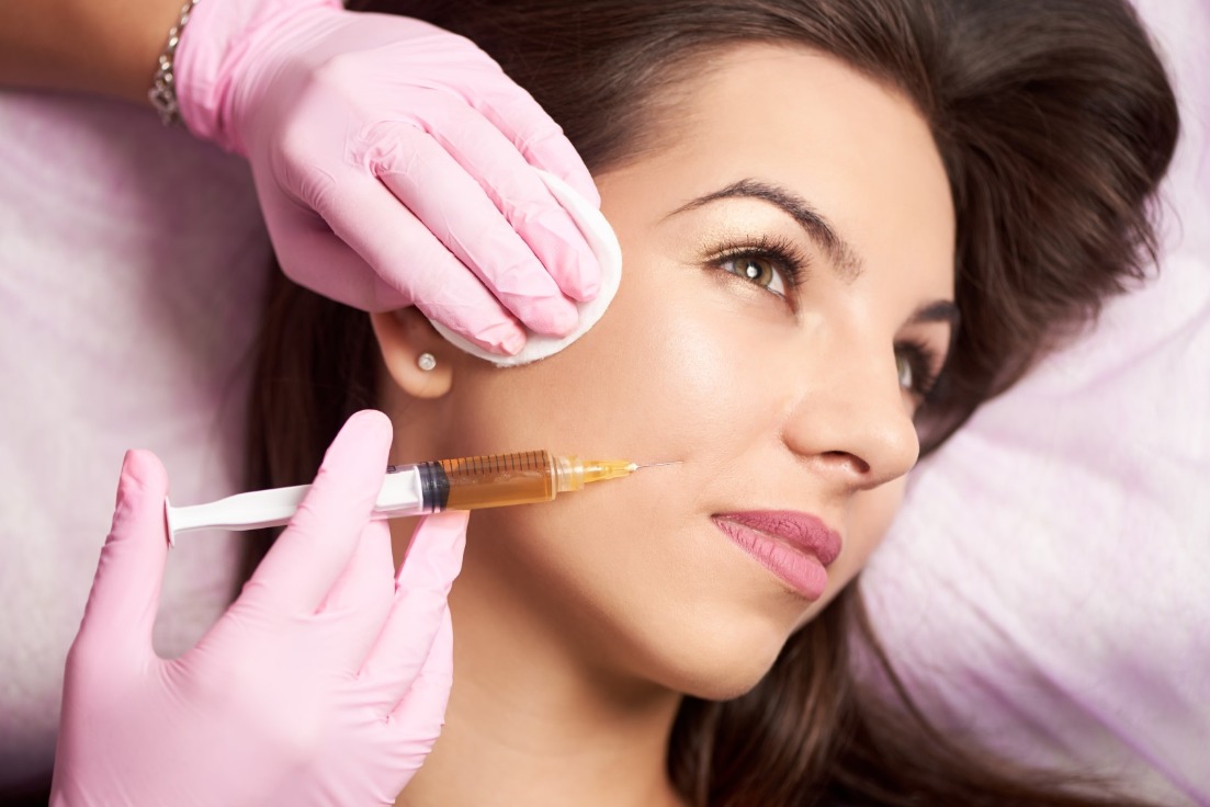 How to reduce lines and wrinkles with dermal fillers