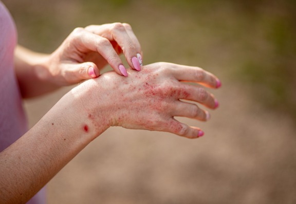 Skin care and digestion are linked Skin care and digestion are linked