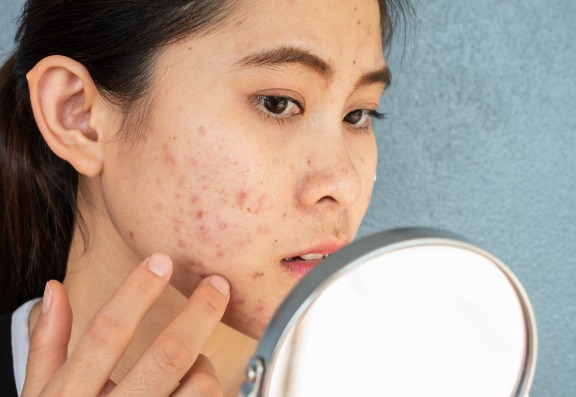 Does red and blue LED treat acne