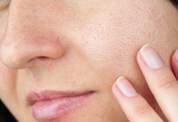 How to figure out what skin type you have