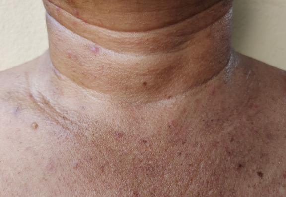 Why Does My Neck Age?