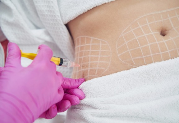 What Areas Can Be Treated with fat dissolving injections?