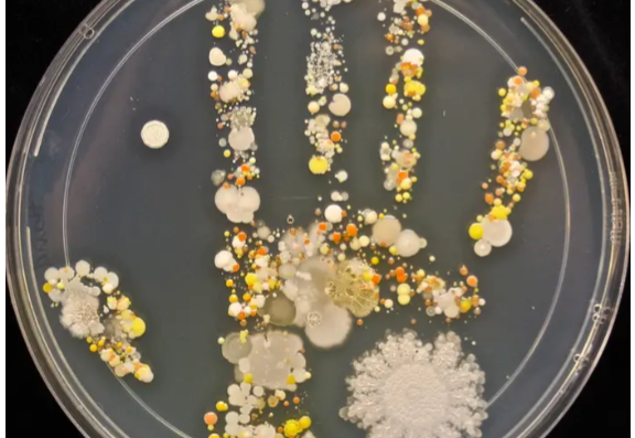 bacteria