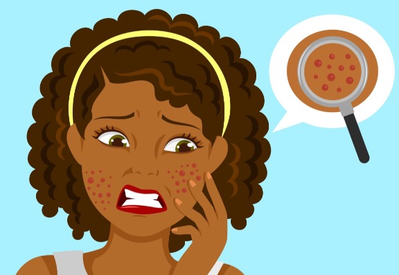 how can stress contribute to a skin condition?