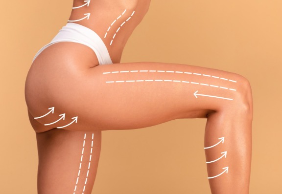 Body Contouring