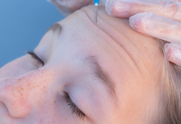 Botox and Lip Fillers Illegally Available