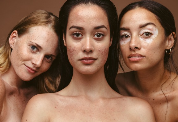 Who can benefit from the Obagi Nu-Derm System? 