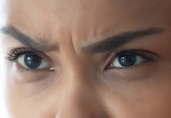 What Can I Expect From Frown Line Treatment?.