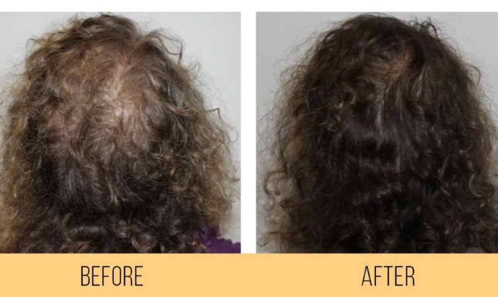 thinning-looking hair, reduced hair growth, dryness and brittle hair.
