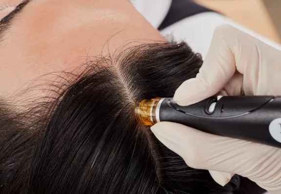 What Does the Hydrafacial Keravive Do?