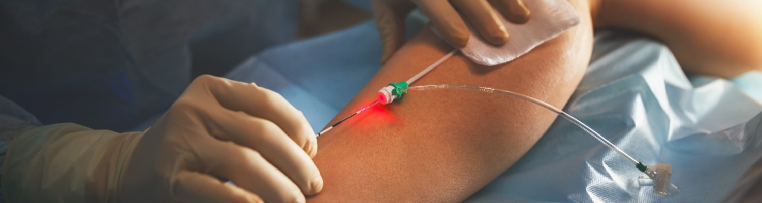thread vein