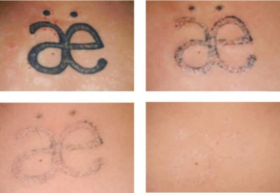 left tattoo