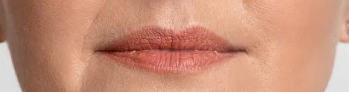 A Guide to Botox for Smoother-Looking Lips