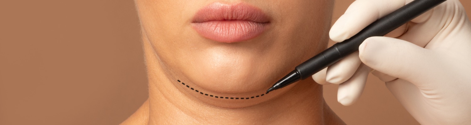Can a Double Chin Be Reduced?
